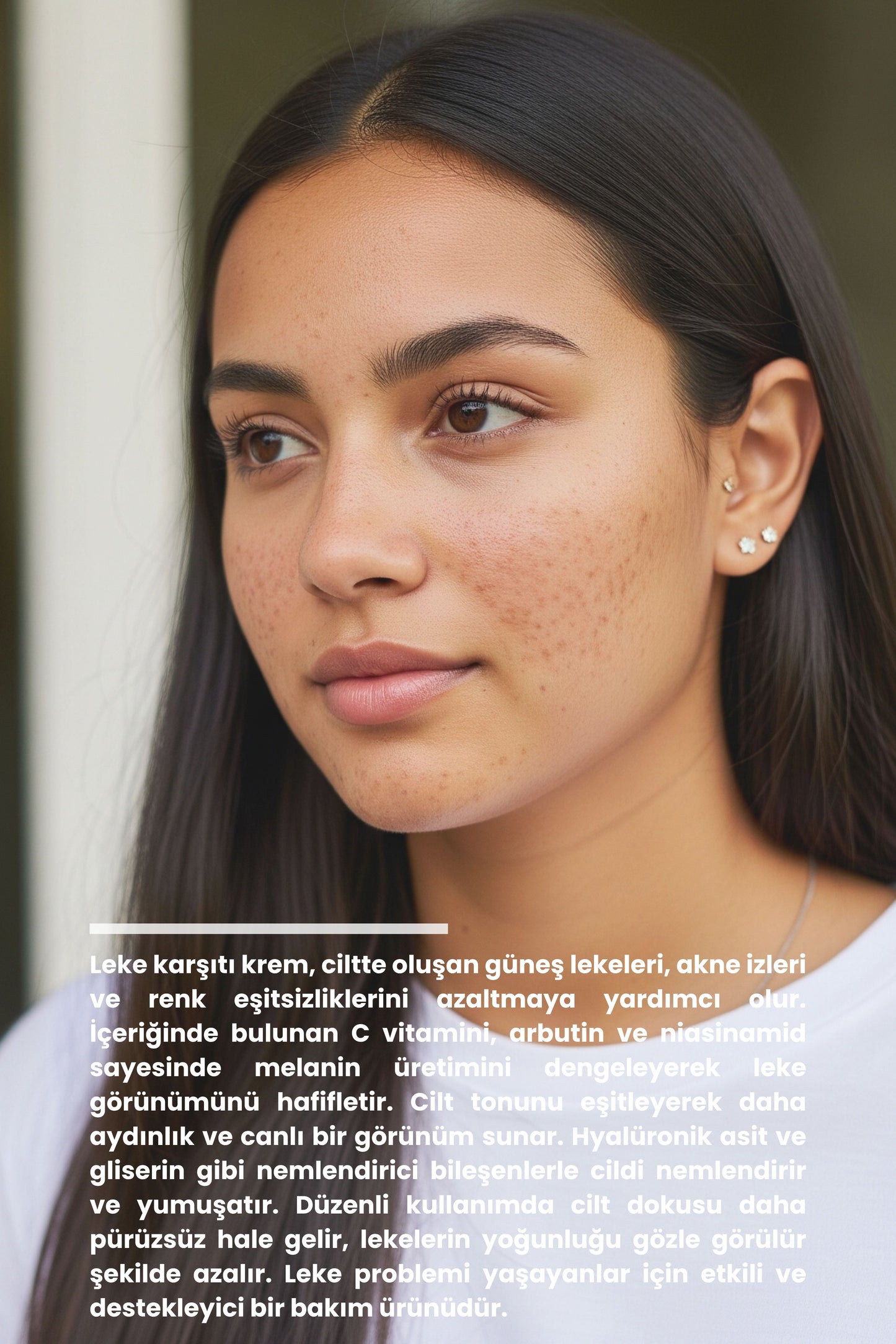 Leke Karşıtı Krem